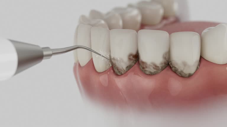 Trusted Teeth Cleaning And Checkup service in Clinton, MI - Dentist Open Now
